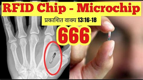 what is the rfid chip 666|microchip theft.